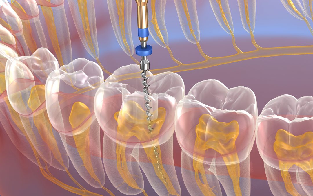 ENDODONZIA