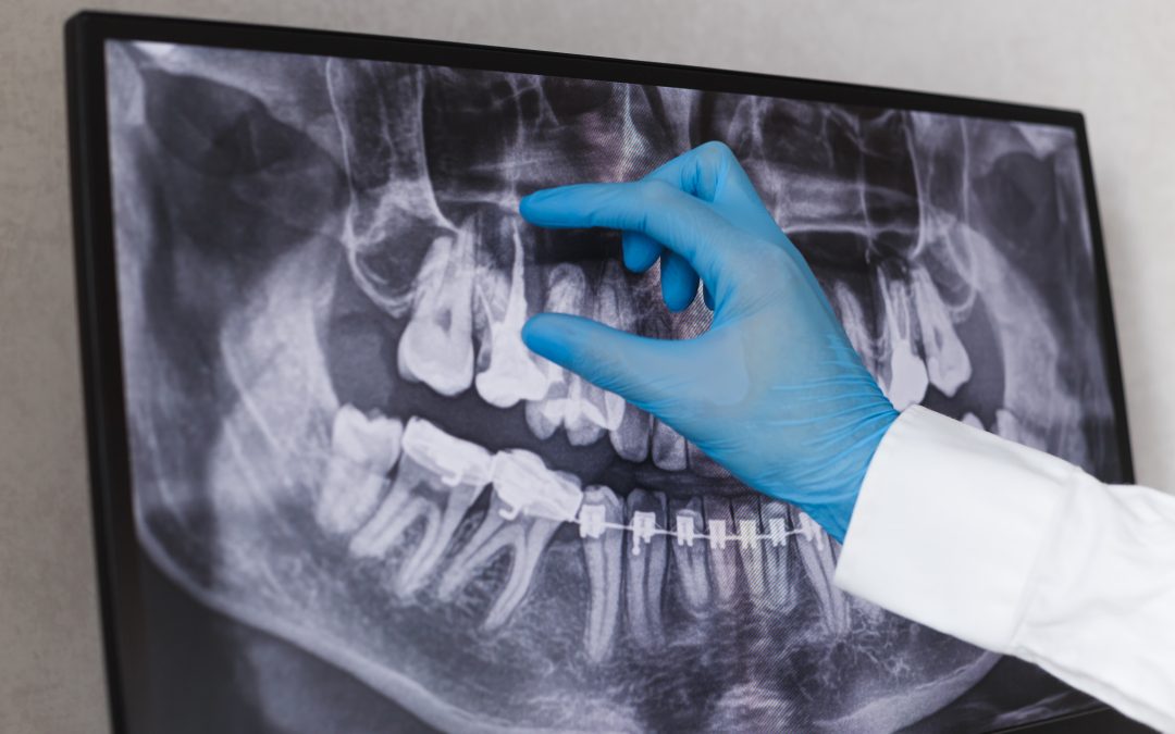 ESAMI RADIOGRAFICI -PANORAMICA DENTALE, TAC COONBEN